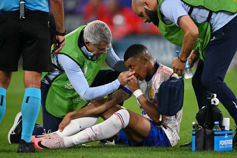 Mbappe Cedera Patah Tulang Hidung